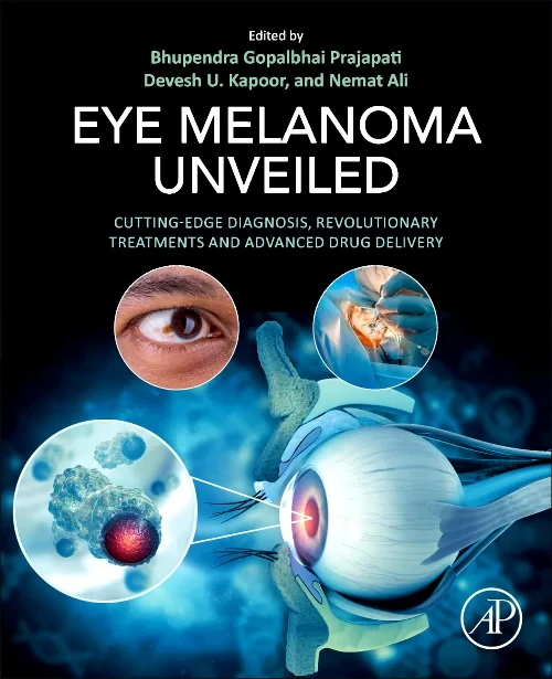 Eye Melanoma Unveiled
