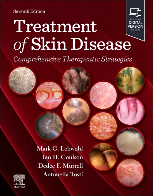 Treatment of Skin Disease: Comprehensive Therapeut...