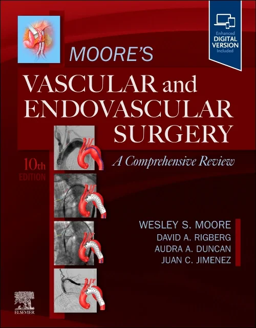 Moore's Vascular and Endovascular Surgery: A Compr...