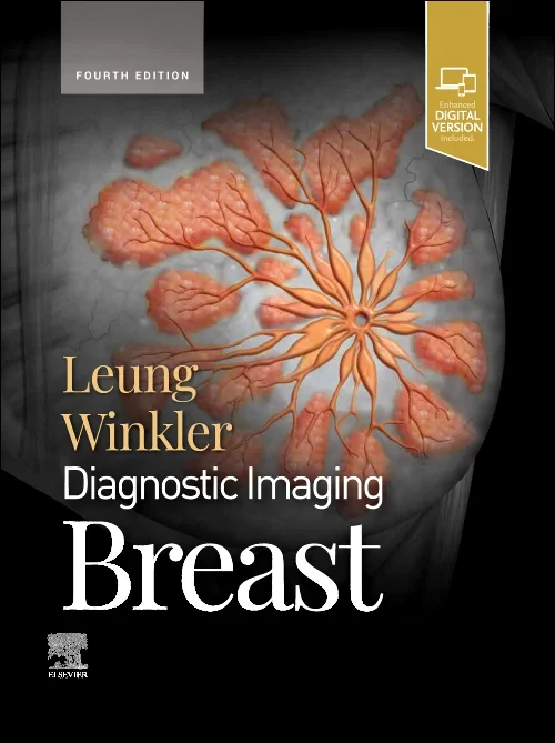 Diagnostic Imaging: Breast