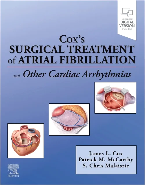Cox’s Surgical Treatment of Atrial Fibrillation
