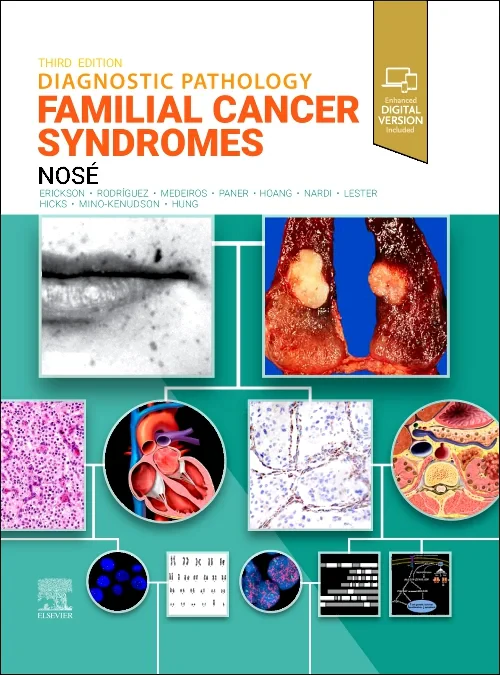 Diagnostic Pathology: Familial Cancer Syndromes