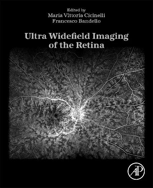 Ultra Widefield Imaging of the Retina
