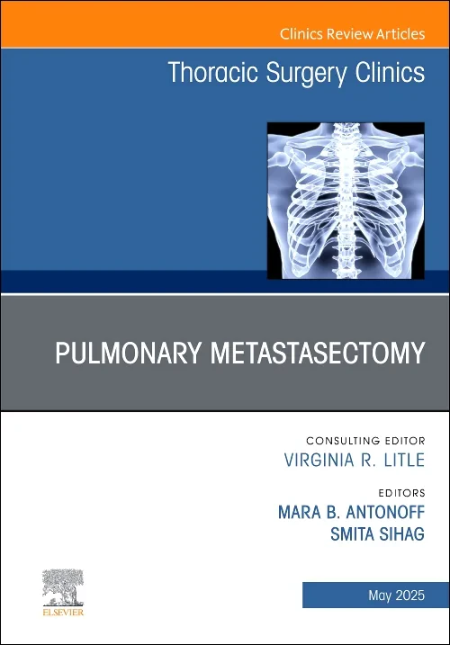 Pulmonary Metastasectomy, An Issue of Thoracic Sur...