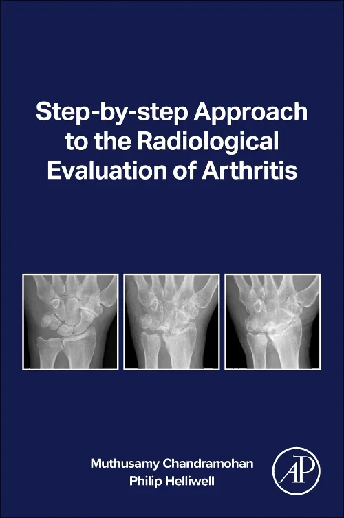 Step-by-step Approach to the Radiological Evaluati...