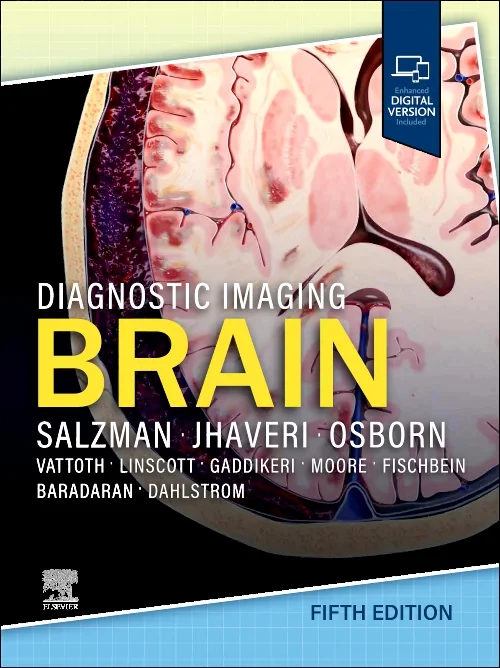 Diagnostic Imaging: Brain