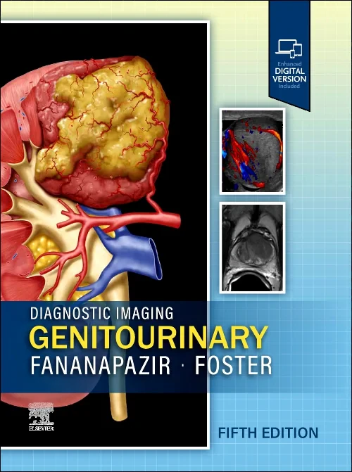 Diagnostic Imaging: Genitourinary