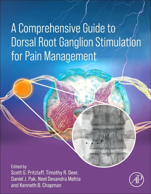 Coperta cărții "A Comprehensive Guide to Dorsal Root Ganglion Stimulation for Pain Management" de autor necunoscut
