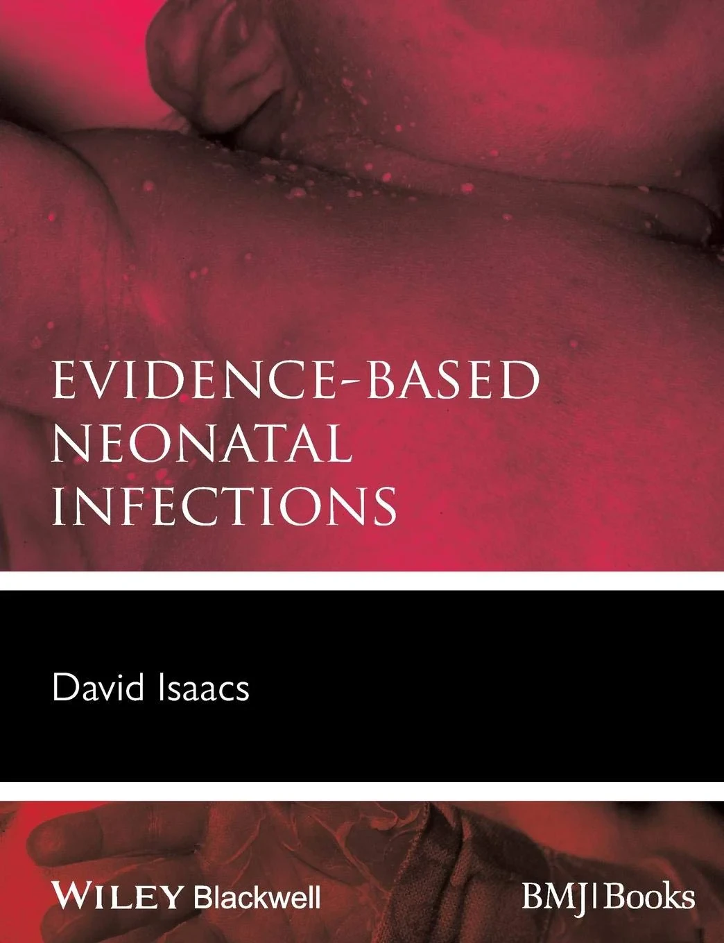 Coperta cărții "Evidence-Based Neonatal Infections" de autor necunoscut