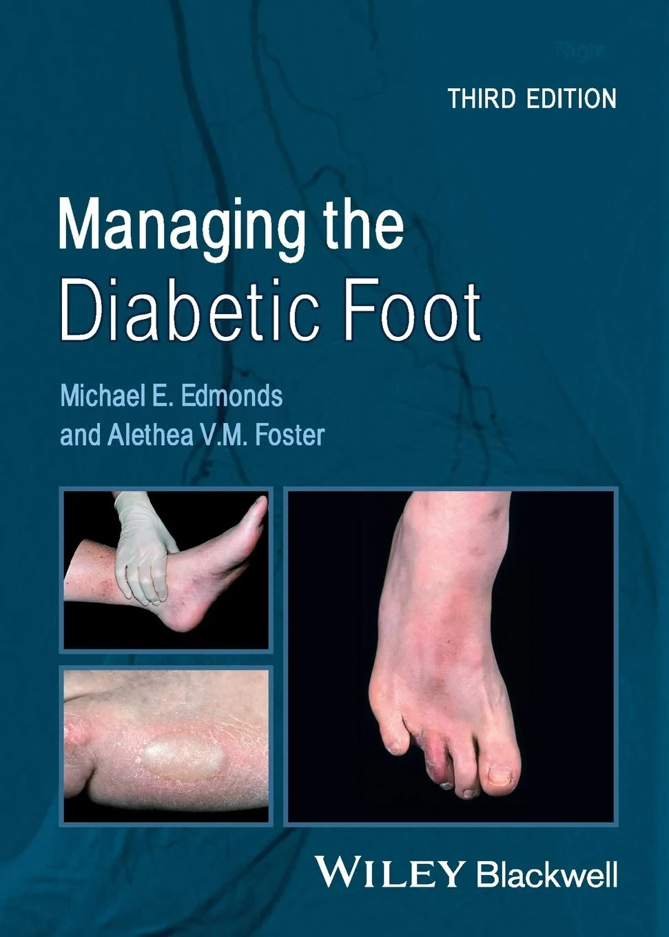 Coperta cărții "Managing the Diabetic Foot" de autor necunoscut