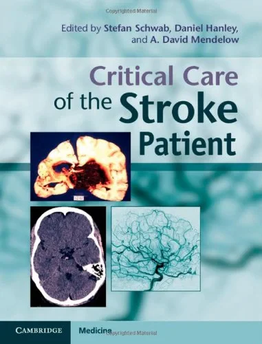 Coperta cărții "Critical Care of the Stroke Patient" de autor necunoscut
