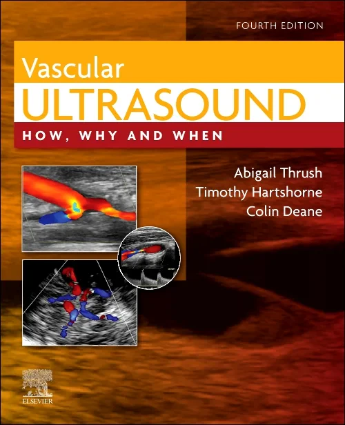 Coperta cărții "Vascular Ultrasound, 4th Edition" de autor necunoscut