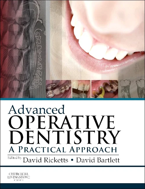 Advanced Operative Dentistry