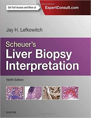 Coperta cărții "Scheuer&amp;#146;s Liver Biopsy Interpretation, 9e" de autor necunoscut