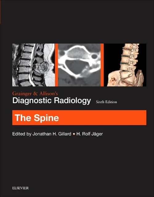 Grainger & Allison’s Diagnostic Radiology: The Spi...