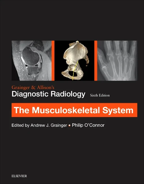 Grainger & Allison’s Diagnostic Radiology: Musculo...