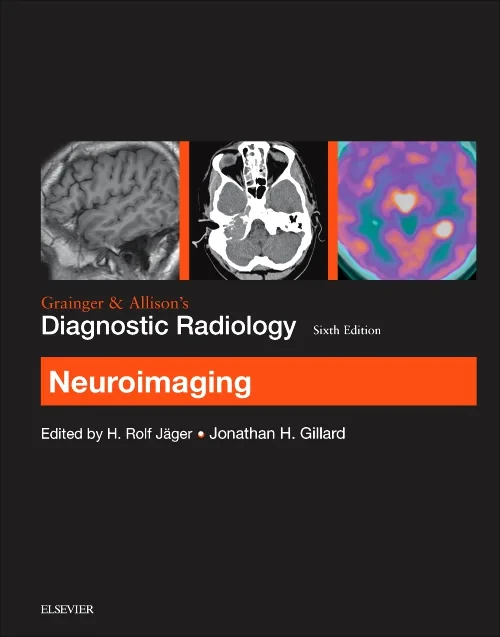 Grainger & Allison’s Diagnostic Radiology: Neuroim...