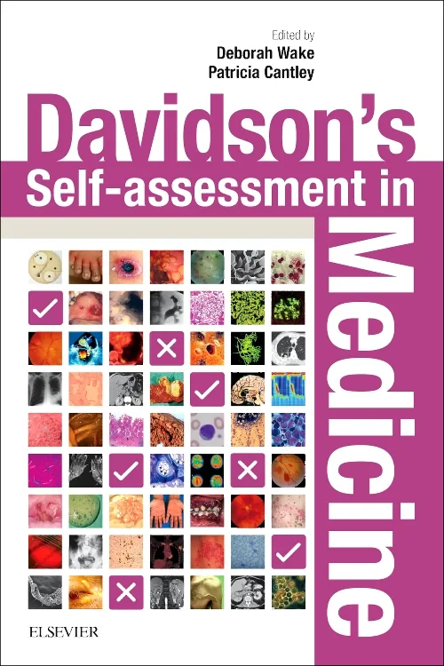 Coperta cărții "Davidson&#039;s Self-assessment in Medicine, 1e" de autor necunoscut