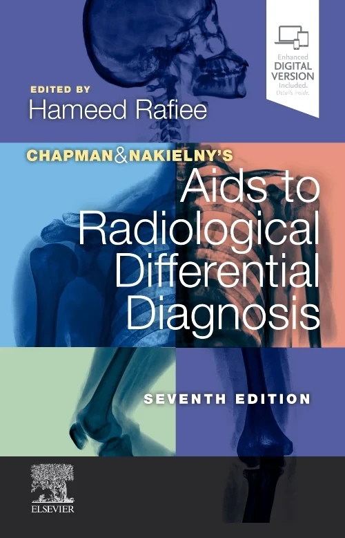Chapman & Nakielny's Aids to Radiological Differen...