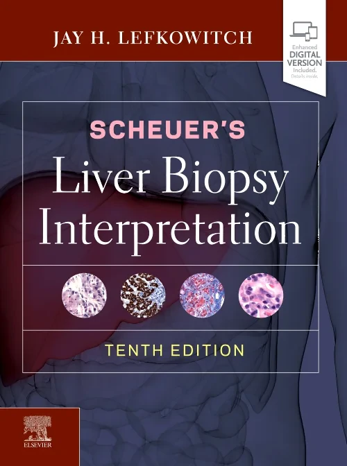 Coperta cărții "Scheuer&amp;#146;s Liver Biopsy Interpretation" de autor necunoscut