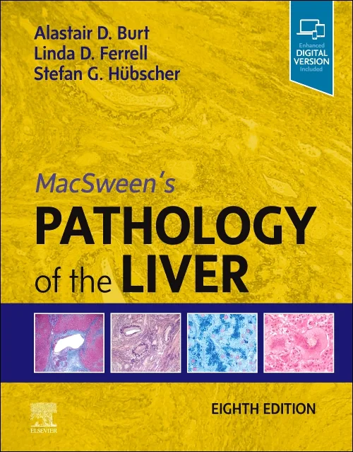 Coperta cărții "MacSween&amp;#146;s Pathology of the Liver" de autor necunoscut