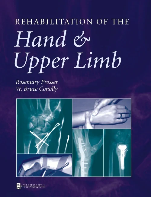 Coperta cărții "Rehabilitation of the Hand and Upper Limb" de autor necunoscut