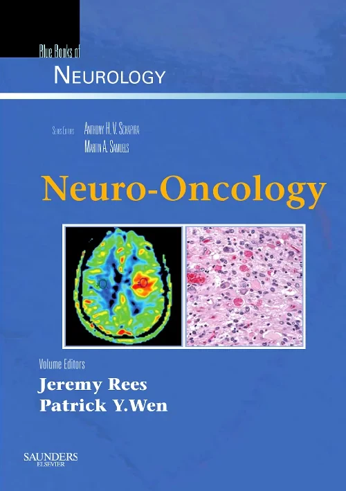 Neuro-Oncology