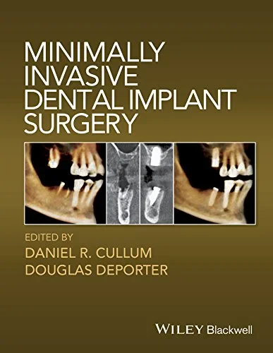 Coperta cărții "Minimally Invasive Dental Implant Surgery" de autor necunoscut