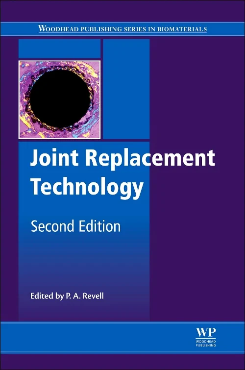 Joint Replacement Technology