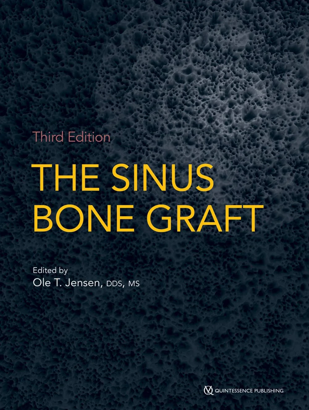 Coperta cărții "The Sinus Bone Graft" de autor necunoscut