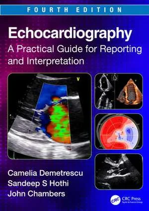 Coperta cărții "Echocardiography: A Practical Guide for Reporting and Interpretation, 4th Edition" de autor necunoscut