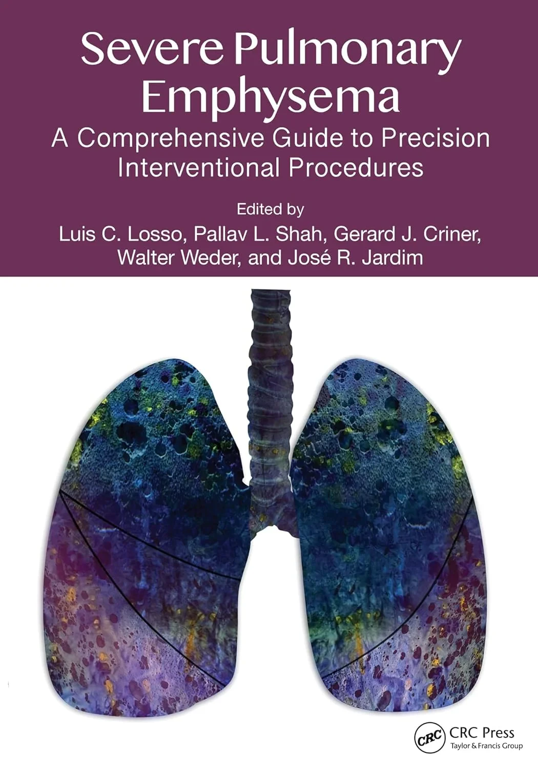Coperta cărții "Severe Pulmonary Emphysema:: A Comprehensive Guide to Precision Interventional Procedures" de autor necunoscut