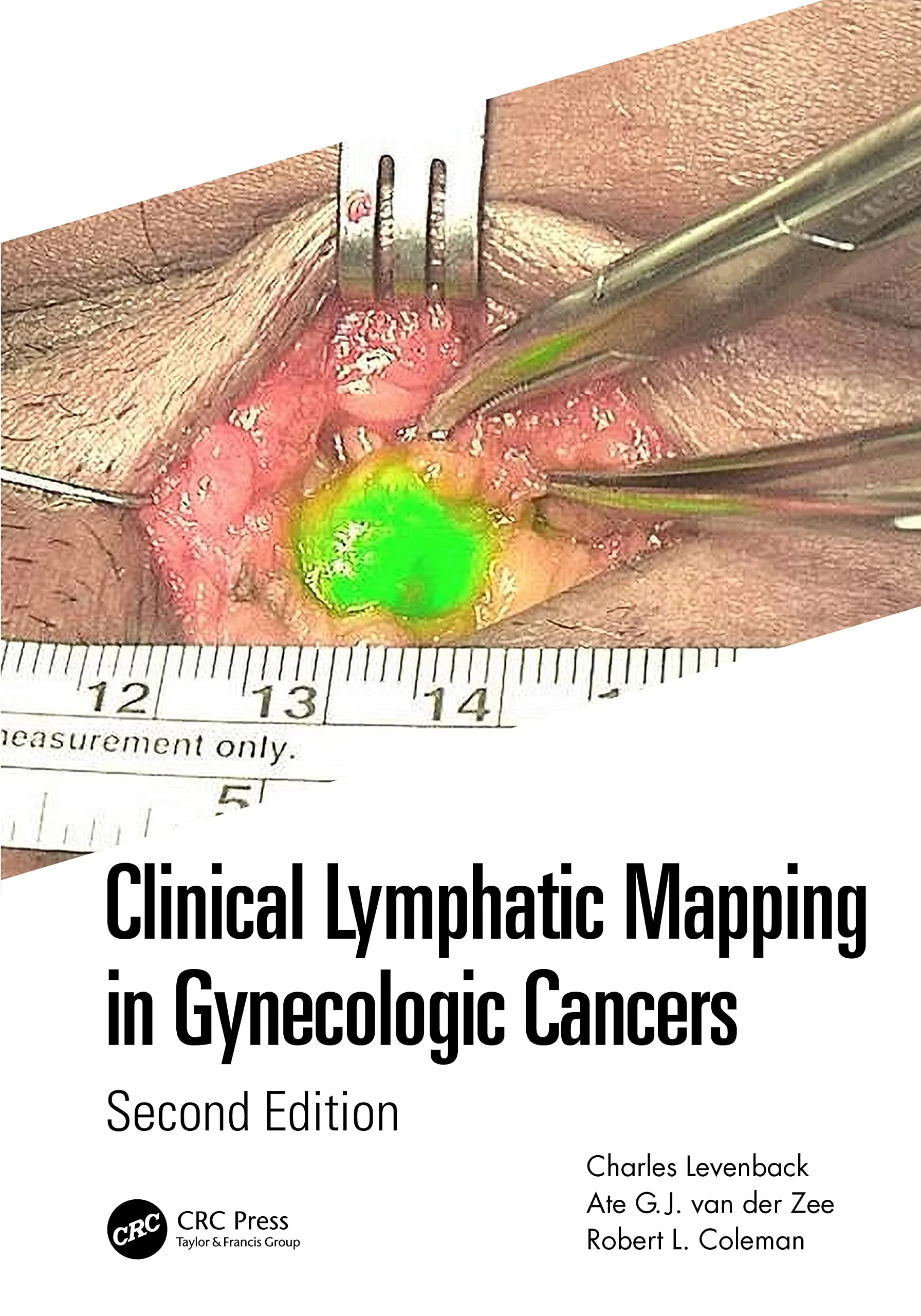 Coperta cărții "Clinical Lymphatic Mapping in Gynecologic Cancers" de autor necunoscut