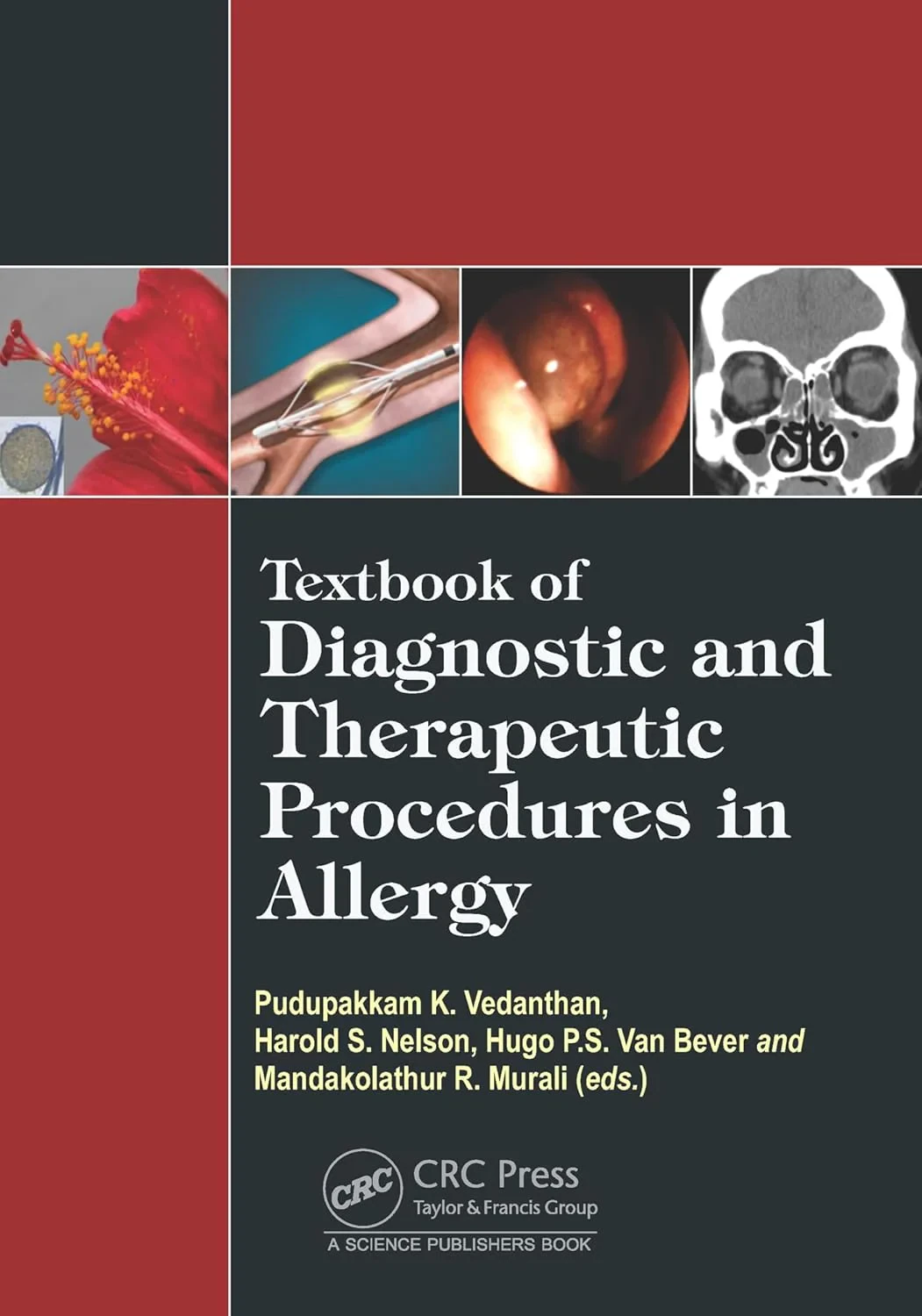 Coperta cărții "Textbook of Diagnostic and Therapeutic Procedures in Allergy" de autor necunoscut