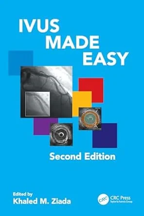 Coperta cărții "IVUS Made Easy 2nd Edition" de autor necunoscut