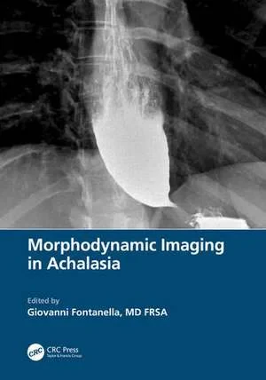 Coperta cărții "Morphodynamic Imaging in Achalasia" de autor necunoscut