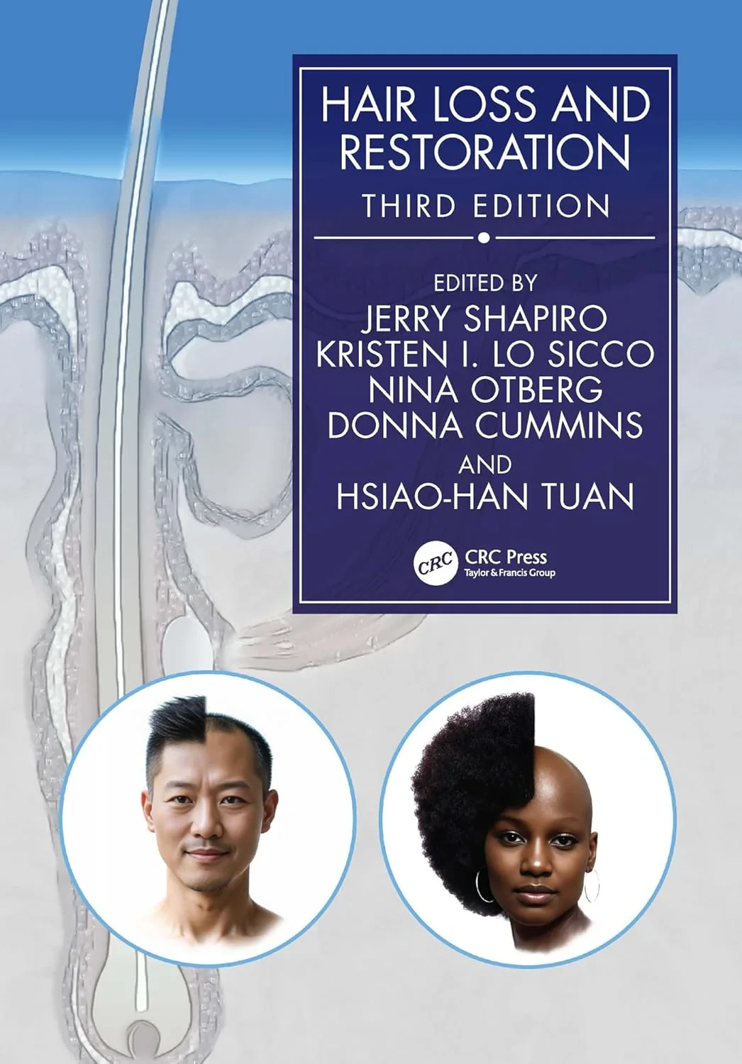 Coperta cărții "Hair Loss and Restoration" de autor necunoscut