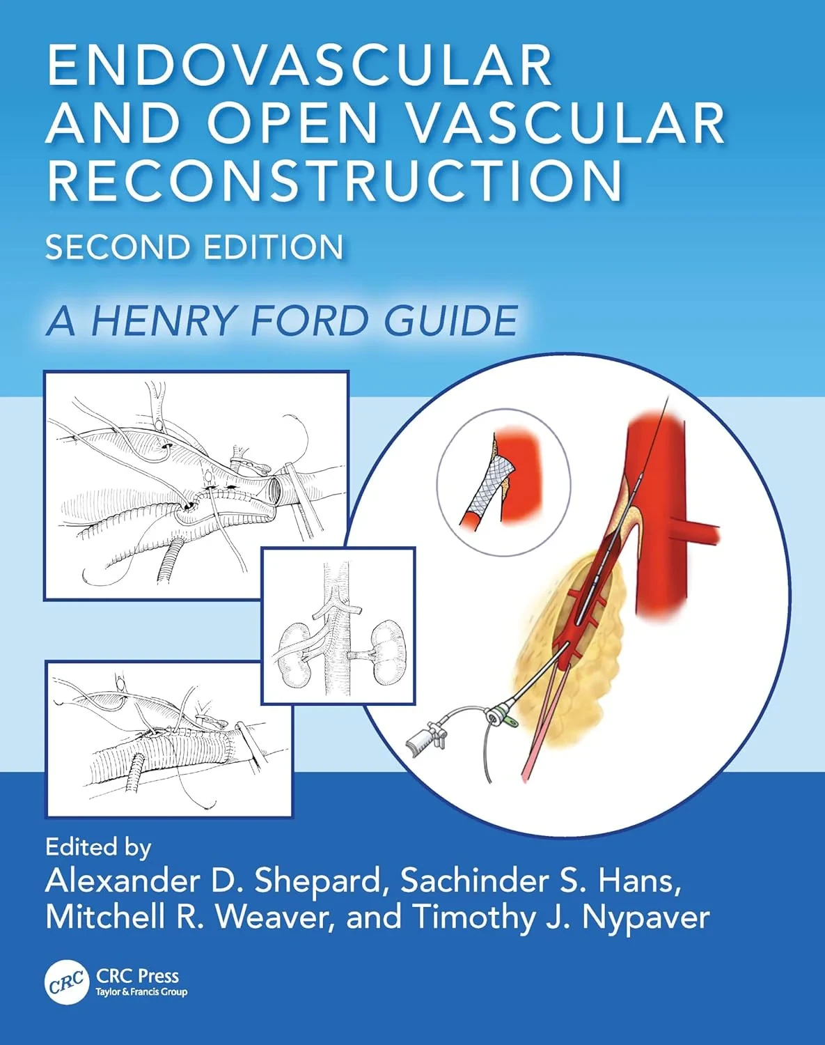 Coperta cărții "Endovascular and Open Vascular Reconstruction: A Henry Ford Surgical Guide 2nd Edition" de autor necunoscut