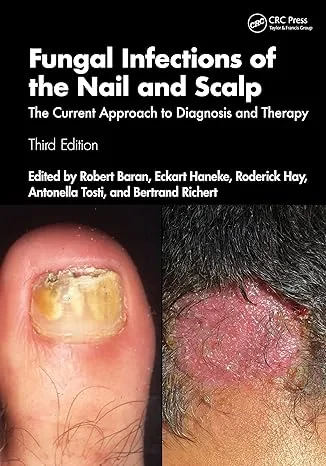 Coperta cărții "Fungal Infections of the Nail and Scalp: The Current Approach to Diagnosis and Therapy" de autor necunoscut