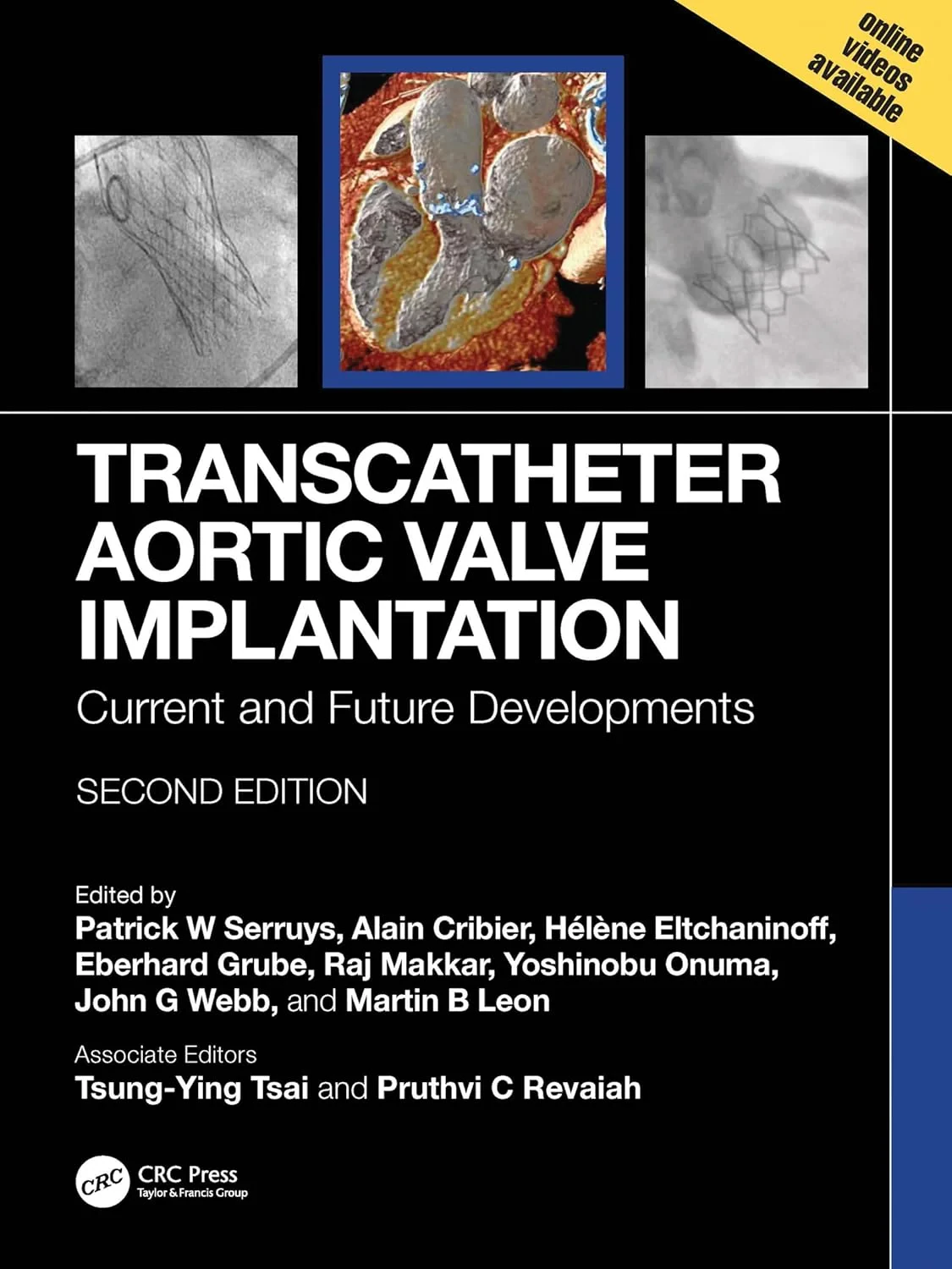 Coperta cărții "Transcatheter Aortic Valve Implantation: Current and Future Developments" de autor necunoscut