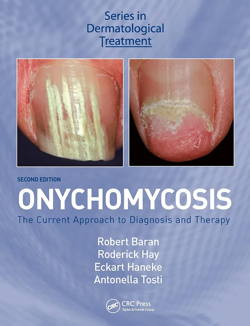 Coperta cărții "Onychomycosis: The Current Approach to Diagnosis and Therapy" de autor necunoscut