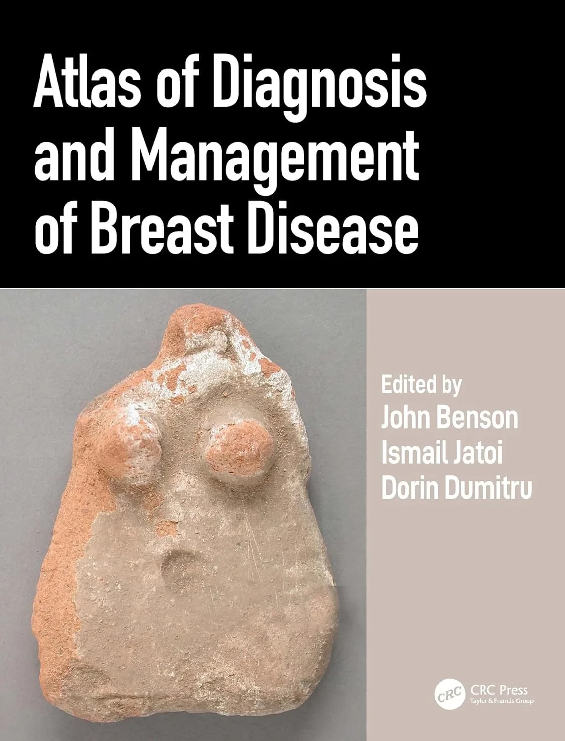 Coperta cărții "Atlas of Diagnosis and Management of Breast Disease" de autor necunoscut