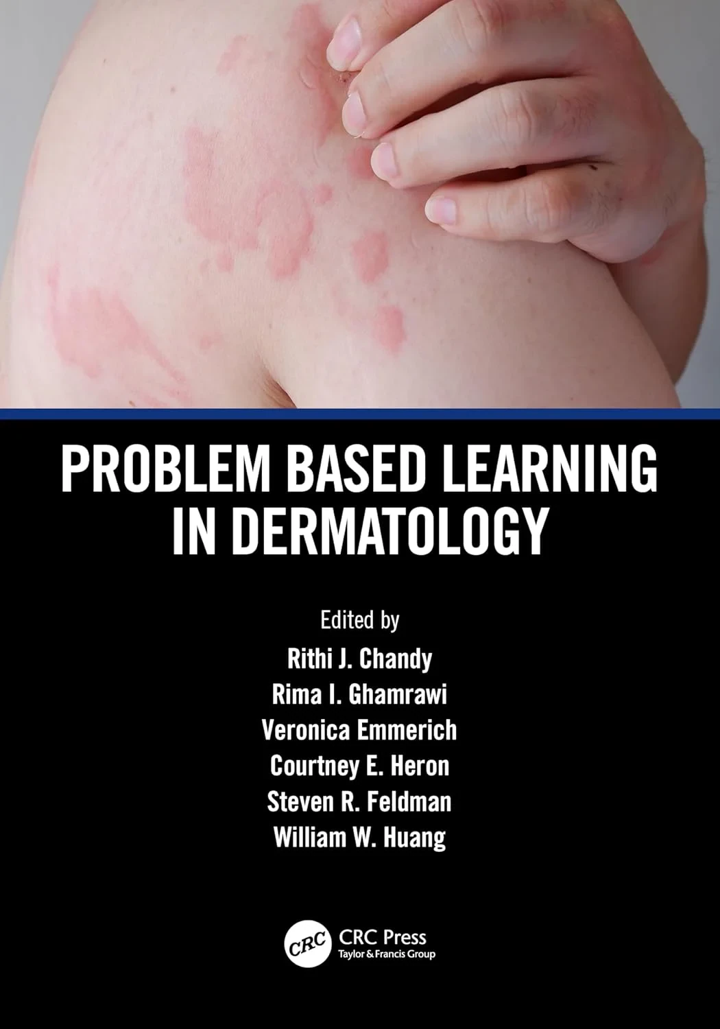 Coperta cărții "Problem Based Learning in Dermatology" de autor necunoscut