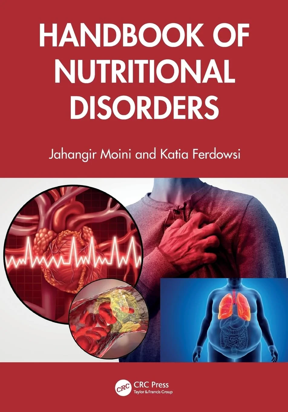 Coperta cărții "Handbook of Nutritional Disorders" de autor necunoscut