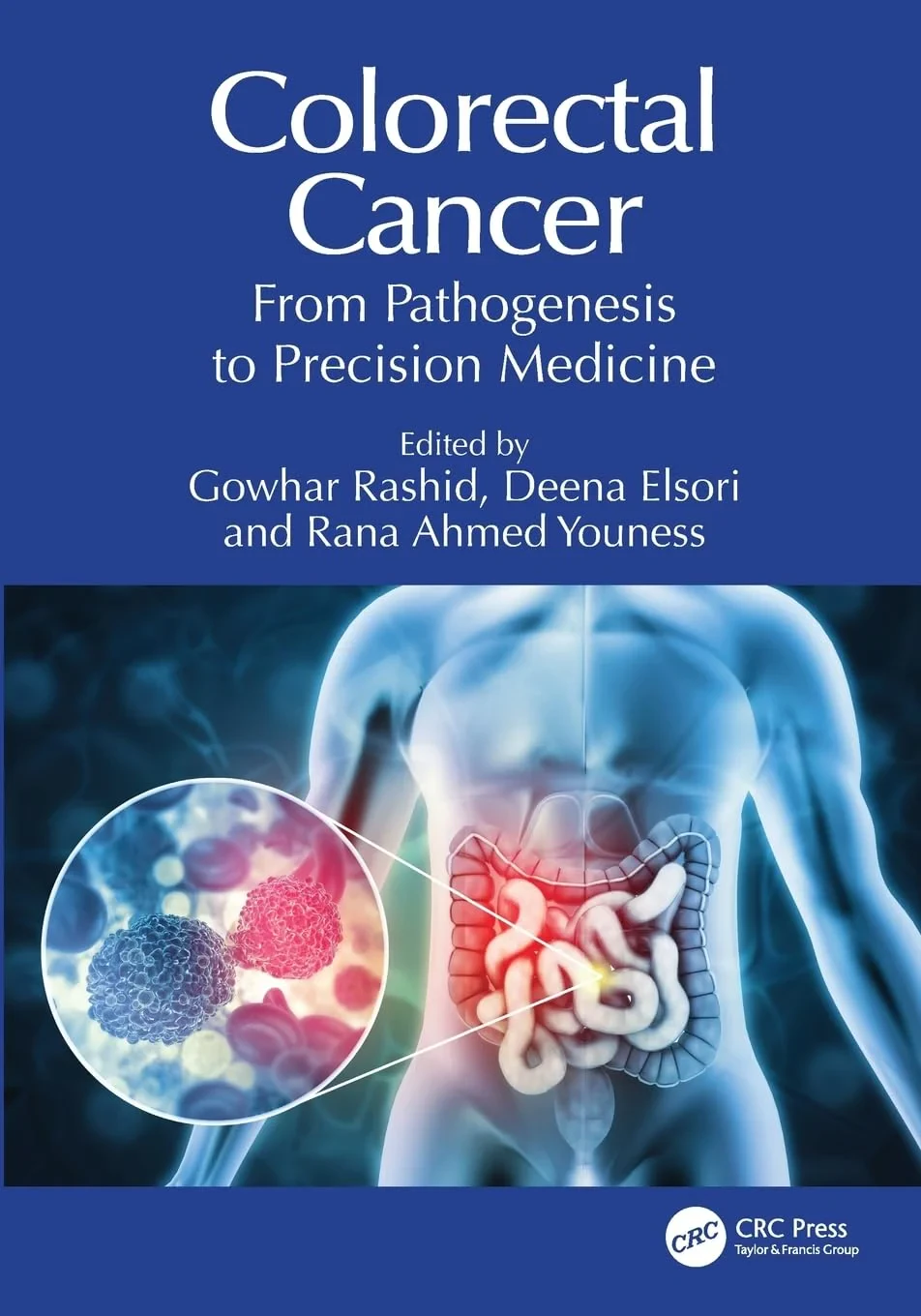 Coperta cărții "Colorectal Cancer: From Pathogenesis to Precision Medicine" de autor necunoscut