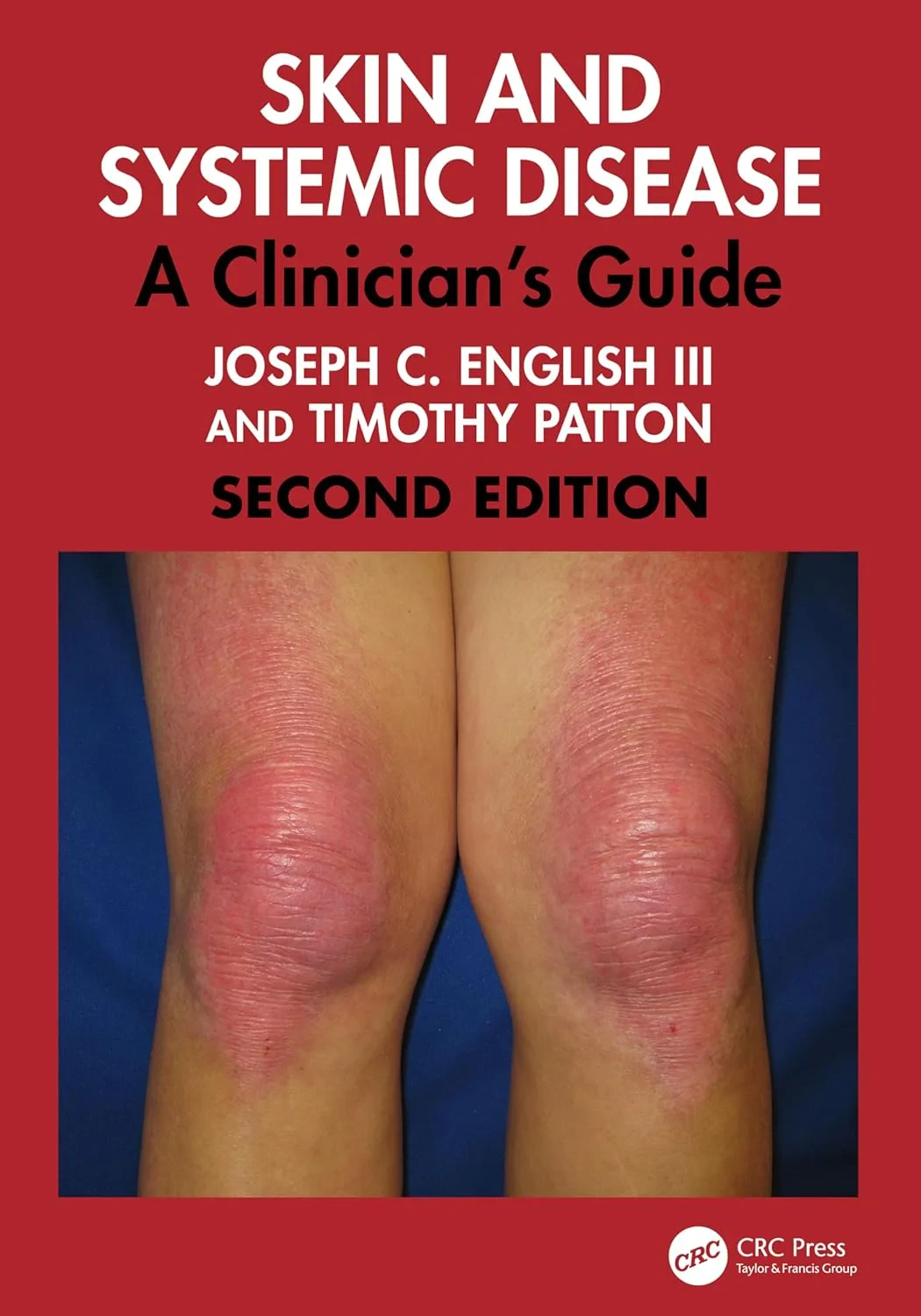Coperta cărții "Skin and Systemic Disease. A Clinician's Guide" de autor necunoscut