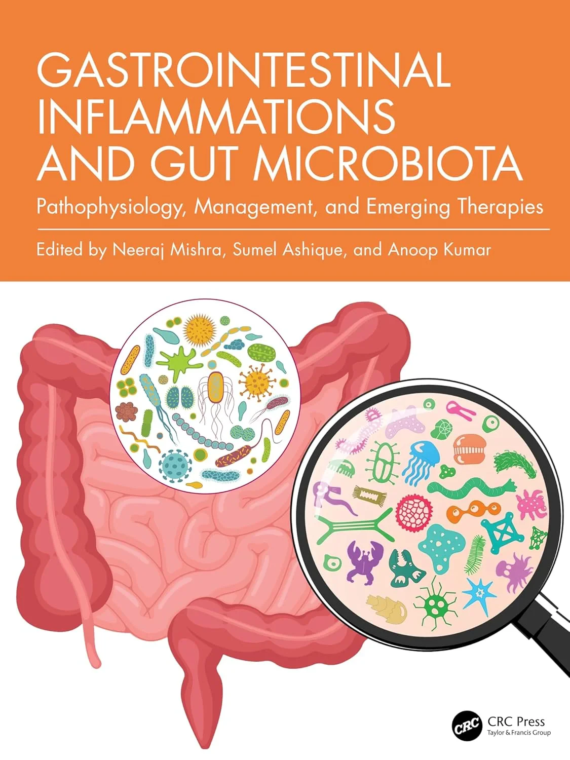 Coperta cărții "Gastrointestinal Inflammations and Gut Microbiota: Pathophysiology, Management, and Emerging Therapies 1st Edition" de autor necunoscut