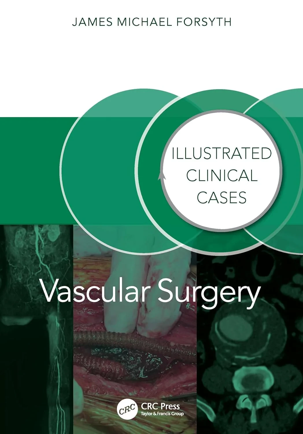 Coperta cărții "Vascular Surgery: Illustrated Clinical Cases" de autor necunoscut