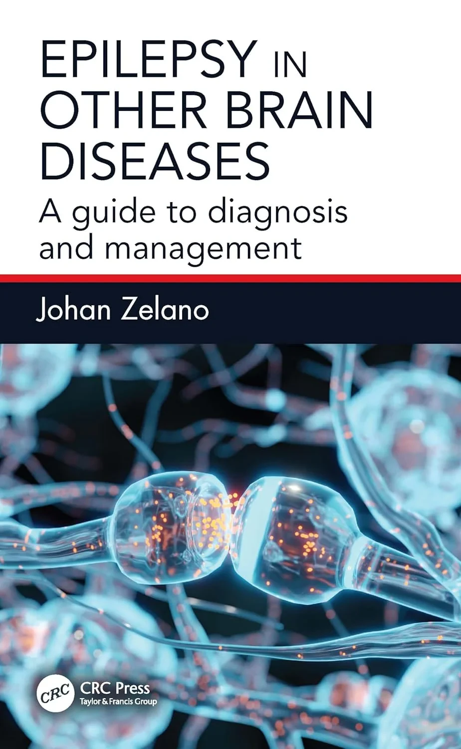 Coperta cărții "Epilepsy in Other Brain Diseases: A Guide to Diagnosis and Management" de autor necunoscut