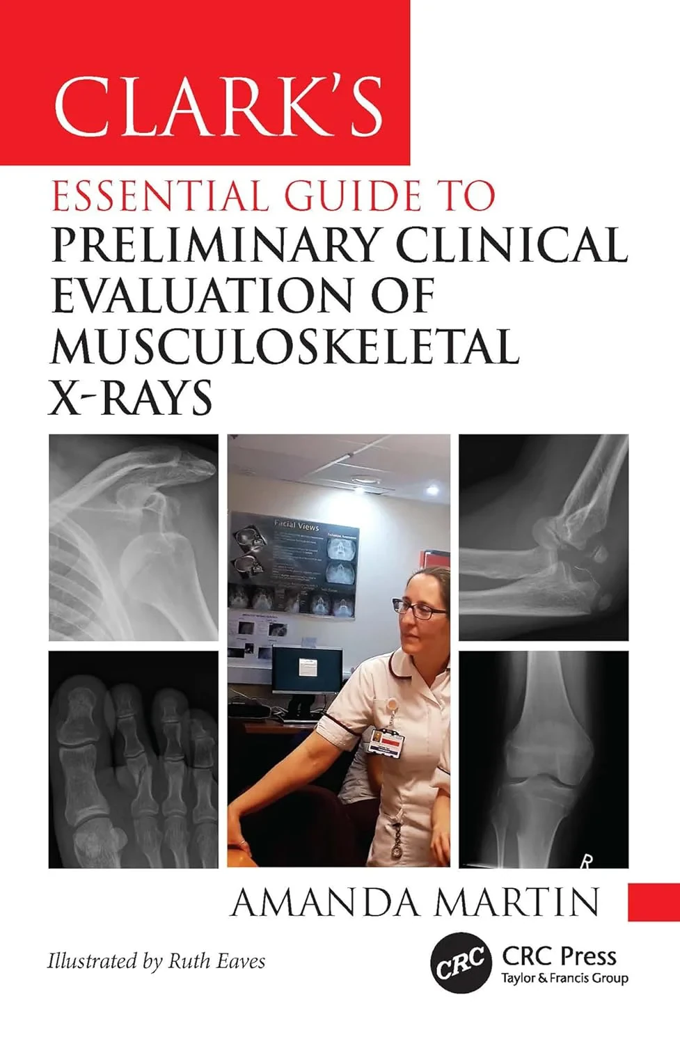 Coperta cărții "Clark&amp;#146;s Essential Guide to Preliminary Clinical Evaluation of Musculoskeletal X-rays" de autor necunoscut